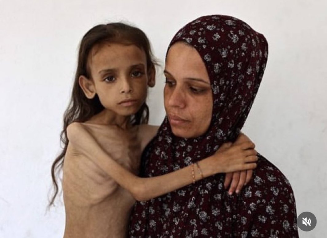 Mariam Dawwas, 9 ans, portée par sa mère Modallala, 33 ans, dans le quartier de Rimal, à Gaza-ville le 2 août 2025 (photo : Omar al-Qattaa pour l’AFP).
